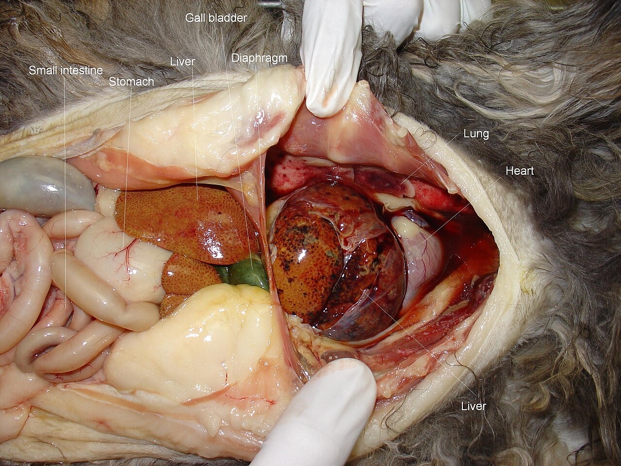 Diaphragmatic Hernia Wikipedia