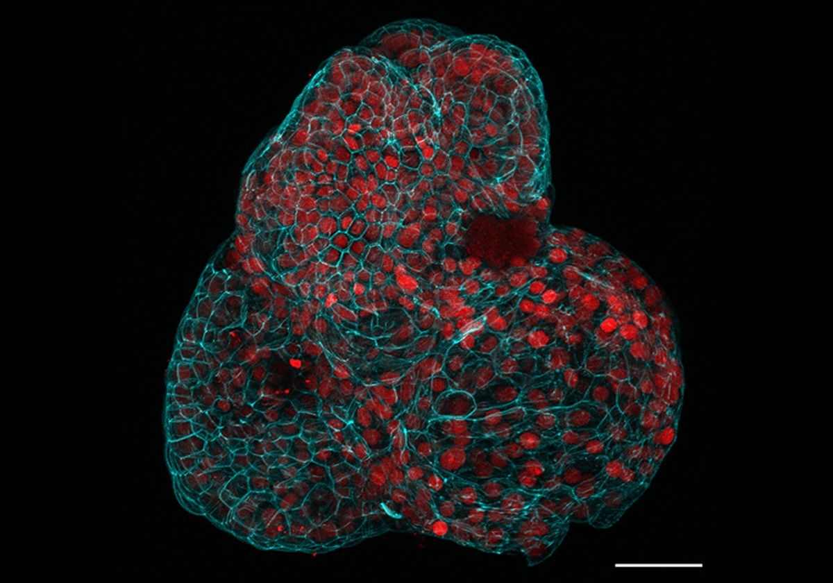 Fetal Organoids Generated From Human Amniotic Fluid The Scientist